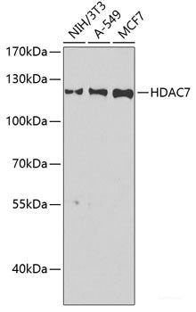 Immunohistochemistry of paraffin-embedded Mouse brain using COQ3 Polyclonal Antibody at dilution of  1:100 (40x lens).