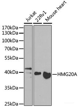 Immunohistochemistry of paraffin-embedded Human kidney using PRKAG3 Polyclonal Antibody at dilution of  1:100 (40x lens).