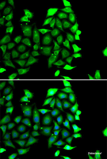 Immunohistochemistry of paraffin-embedded Rat heart using THAP1 Polyclonal Antibody at dilution of  1:100 (40x lens).