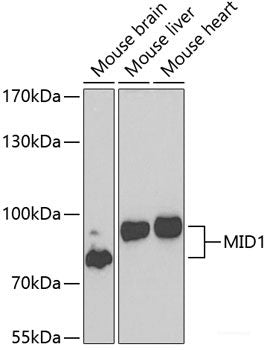 Western blot analysis of extracts of various cell lines using GSDMB Polyclonal Antibody at dilution of 1:1000.