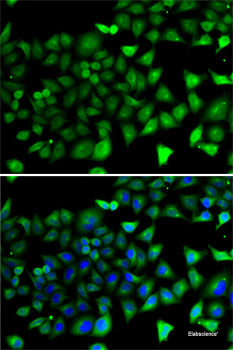 Western blot analysis of extracts of HL-60 cells using RPGRIP1 Polyclonal Antibody at dilution of 1:1000.