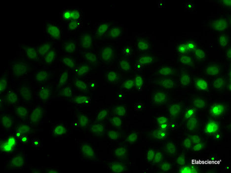 Immunohistochemistry of paraffin-embedded Rat kidney using ZFAND3 Polyclonal Antibody at dilution of  1:100 (40x lens).