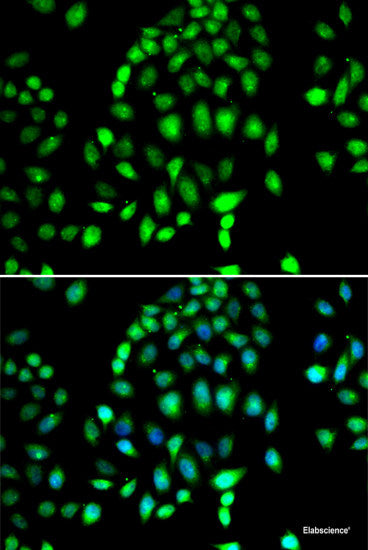 Immunohistochemistry of paraffin-embedded Rat intestine using RRAGC Polyclonal Antibody at dilution of  1:100 (40x lens).