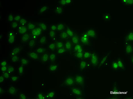 Western blot analysis of extracts of Mouse testis using SPAG16 Polyclonal Antibody at dilution of 1:1000.