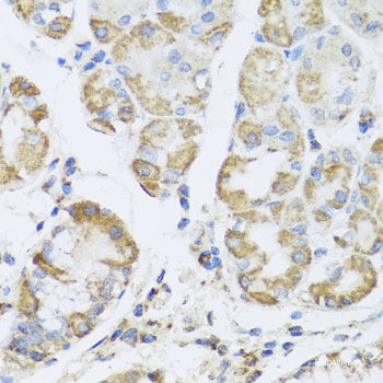 Western blot analysis of extracts of Mouse testis using HDGFRP2 Polyclonal Antibody at dilution of 1:1000.