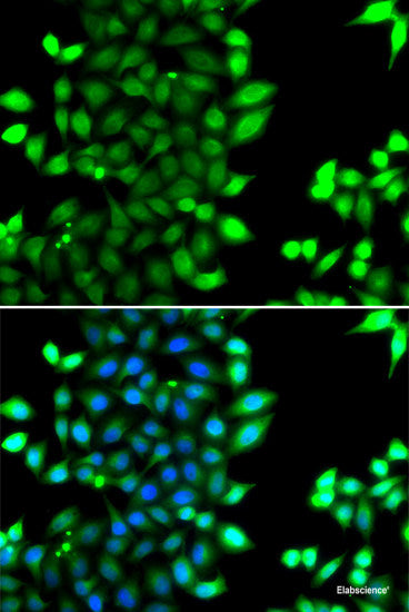 Western blot analysis of extracts of various cell lines using CNDP1 Polyclonal Antibody at dilution of 1:1000.