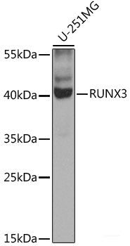 Immunohistochemistry of paraffin-embedded Human kidney cancer using ZNF169 Polyclonal Antibody at dilution of  1:100 (40x lens).