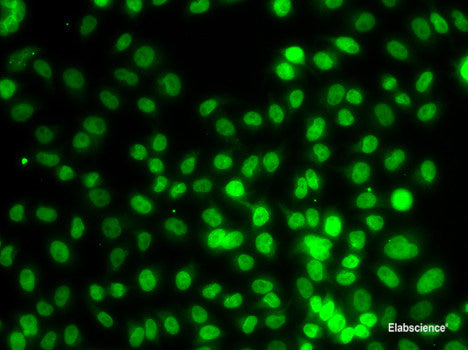 Western blot analysis of extracts of various cell lines using HCCS Polyclonal Antibody at dilution of 1:1000.