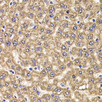 Immunohistochemistry of paraffin-embedded Rat kidney using ALDH1A2 Polyclonal Antibody at dilution of  1:100 (40x lens).