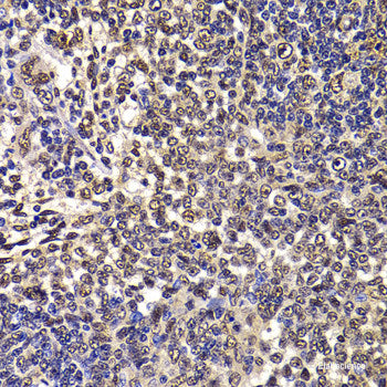 Immunofluorescence analysis of A549 cells using USP10 Polyclonal Antibody
