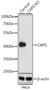 Immunohistochemistry of paraffin-embedded Human gastric using SESN2 Polyclonal Antibody at dilution of  1:100 (40x lens).