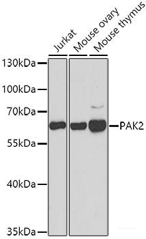 Immunohistochemistry of paraffin-embedded Rat testis using ATG14 Polyclonal Antibody at dilution of  1:100 (40x lens).