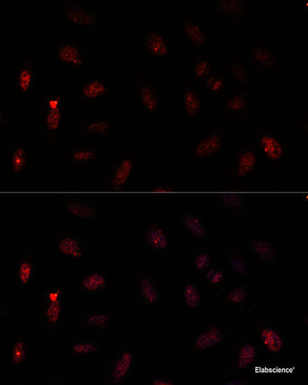 Immunofluorescence analysis of A549 cells using ZFYVE1 Polyclonal Antibody