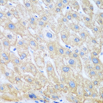 Immunohistochemistry of paraffin-embedded Rat brain using CBR3 Polyclonal Antibody at dilution of  1:100 (40x lens).