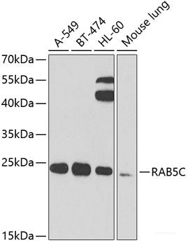 Immunohistochemistry of paraffin-embedded Rat brain using CHN1 Polyclonal Antibody at dilution of  1:100 (40x lens).