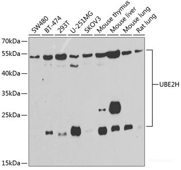 Western blot analysis of extracts of Mouse esophagus using COX10 Polyclonal Antibody at dilution of 1:1000.