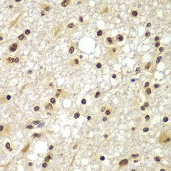 Immunohistochemistry of paraffin-embedded Mouse lung using CYP2F1 Polyclonal Antibody at dilution of  1:200 (40x lens).