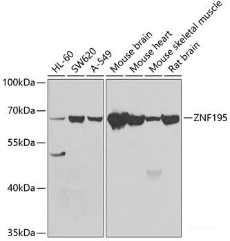 Immunohistochemistry of paraffin-embedded Rat heart using DVL2 Polyclonal Antibody at dilution of  1:100 (40x lens).