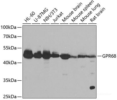 Immunohistochemistry of paraffin-embedded Human liver damage using EIF4G1 Polyclonal Antibody at dilution of  1:100 (40x lens).