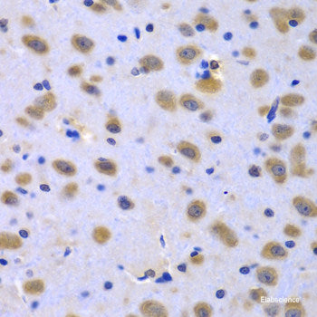 Immunohistochemistry of paraffin-embedded Rat kidney using INHBC Polyclonal Antibody at dilution of  1:100 (40x lens).