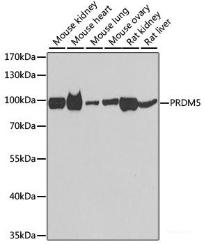 Western blot analysis of extracts of Rat heart using MYH7 Polyclonal Antibody at dilution of 1:1000.