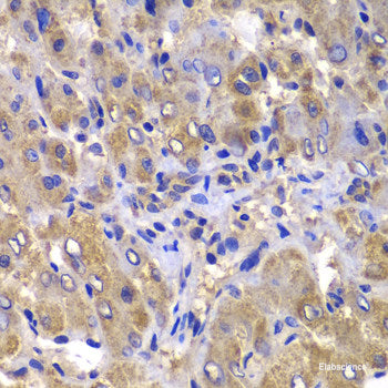 Immunohistochemistry of paraffin-embedded Human liver using CCL3 Polyclonal Antibody at dilution of  1:100 (40x lens).
