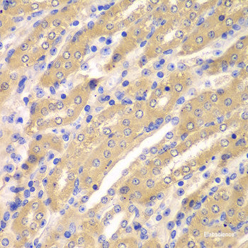 Immunohistochemistry of paraffin-embedded Human liver damage using UGT2B10 Polyclonal Antibody at dilution of  1:100 (40x lens).