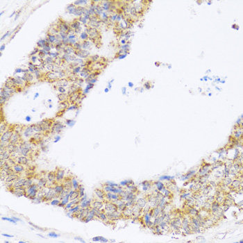 Immunofluorescence analysis of A549 cells using ZSCAN26 Polyclonal Antibody