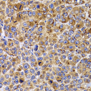 Immunofluorescence analysis of A549 cells using TBPL1 Polyclonal Antibody