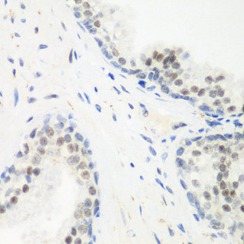 Immunofluorescence analysis of A549 cells using WDR45 Polyclonal Antibody