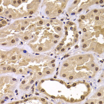 Immunofluorescence analysis of A549 cells using FANCM Polyclonal Antibody