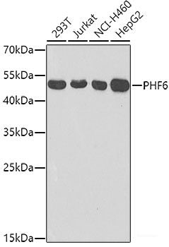 Immunofluorescence analysis of U2OS cells using CENPQ Polyclonal Antibody at dilution of  1:100. Blue: DAPI for nuclear staining.
