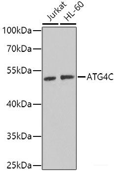 Immunohistochemistry of paraffin-embedded Human liver damage using Desmoplakin Polyclonal Antibody at dilution of  1:100 (40x lens).