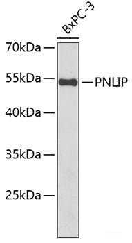 Immunofluorescence analysis of HeLa cells using ARF1 Polyclonal Antibody at dilution of  1:100. Blue: DAPI for nuclear staining.