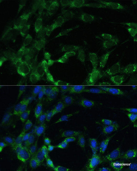 Immunohistochemistry of paraffin-embedded Human stomach using BCS1L Polyclonal Antibody at dilution of  1:100 (40x lens).