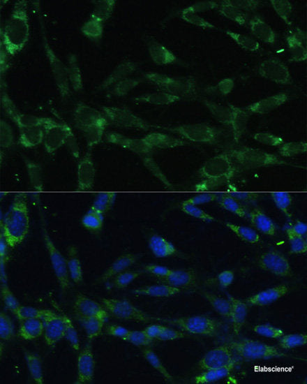 Western blot analysis of extracts of various cell lines using C4BPA Polyclonal Antibody at dilution of 1:1000.