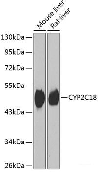Western blot analysis of extracts of HepG2 cells using CACNB1 Polyclonal Antibody at dilution of 1:1000.