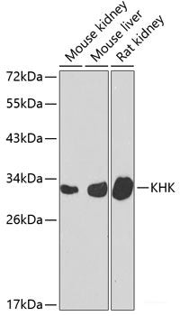 Immunohistochemistry of paraffin-embedded Rat lung using CHI3L2 Polyclonal Antibody at dilution of  1:100 (40x lens).