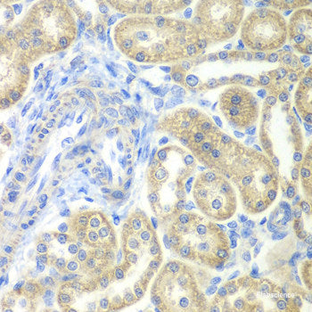 Immunofluorescence analysis of A549 cells using CIDEA Polyclonal Antibody