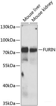 Western blot analysis of extracts of various cell lines using CTSV Polyclonal Antibody at dilution of 1:1000.