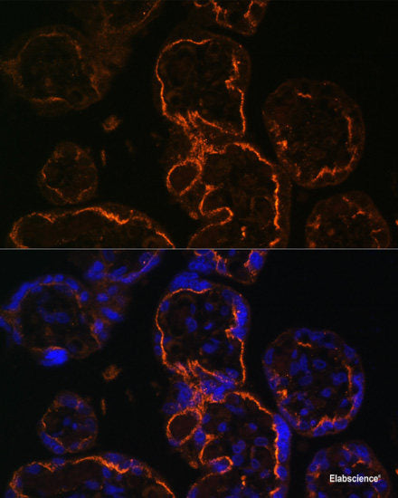 Western blot analysis of extracts of various cell lines using GSTA2 Polyclonal Antibody at dilution of 1:1000.
