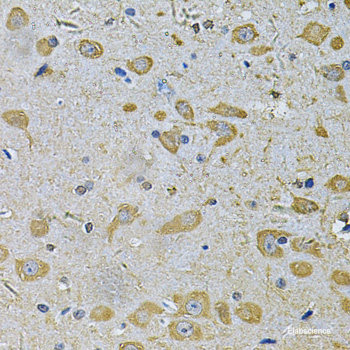 Immunofluorescence analysis of C6 cells using GSTM3 Polyclonal Antibody at dilution of  1:100. Blue: DAPI for nuclear staining.
