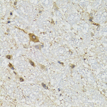 Immunofluorescence analysis of U2OS cells using HOXD10 Polyclonal Antibody at dilution of  1:100. Blue: DAPI for nuclear staining.