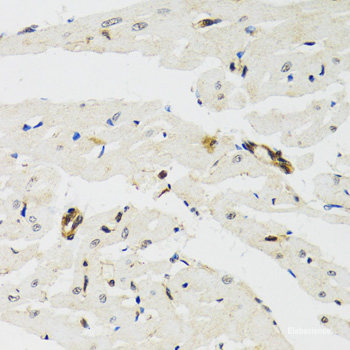 Western blot analysis of extracts of various cell lines using HSPA6 Polyclonal Antibody at dilution of 1:1000.