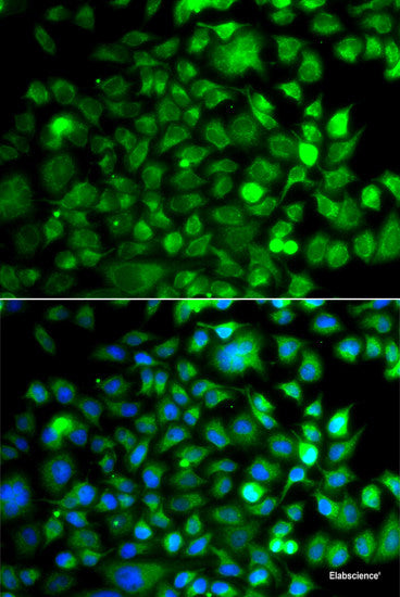 Immunohistochemistry of paraffin-embedded Human prostate using IGSF3 Polyclonal Antibody