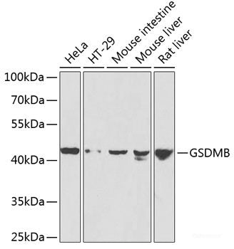 Western blot analysis of extracts of various cell lines using IL5 Polyclonal Antibody at dilution of 1:1000.