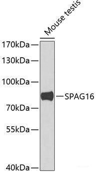 Immunofluorescence analysis of U2OS cells using NBN Polyclonal Antibody at dilution of  1:100. Blue: DAPI for nuclear staining.