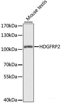 Immunohistochemistry of paraffin-embedded Rat brain using PLCG1 Polyclonal Antibody at dilution of  1:100 (40x lens).
