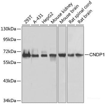 Western blot analysis of extracts of Jurkat cells using POU4F3 Polyclonal Antibody at dilution of 1:1000.