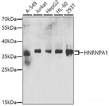 Immunohistochemistry of paraffin-embedded Human well-differentiated squamous skin carcinoma using PRKDC Polyclonal Antibody at dilution of  1:100 (40x lens).